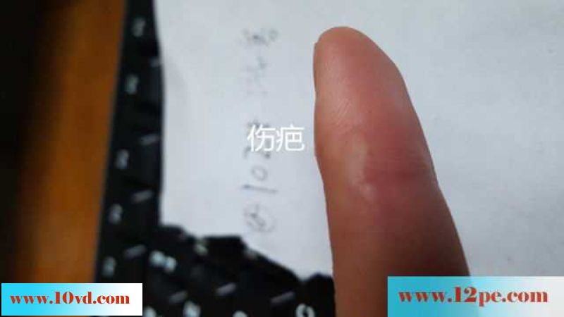 这木耳真的没谁了，伤疤认证(10P)